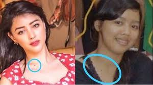 Disebut Terima Uang dari Kasus Suap Pajak, Potret Siwi Widi Sebelum Operasi  Plastik Beredar di Media Sosial