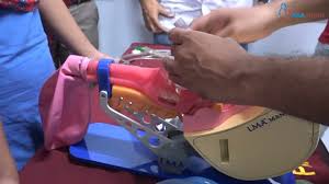 Image result for Extraglottic Device