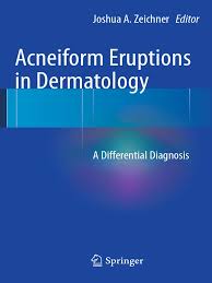 Check spelling or type a new query. Shinjita Das M D Rachel Reynolds M D Auth Joshua Zeichner Eds Acneiform Eruptions In Dermatology A Differential Diagnosis Springer Verlag New York 2014 Pdf Interleukin 8 Immune System