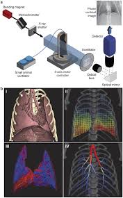 Apical parenchymal scarring, for example, is scarring at the tip of the lung. Quantification Of Heterogeneity In Lung Disease With Image Based Pulmonary Function Testing Scientific Reports