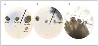 Image result for scabies microscopic images