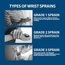 Wrist Sprains Information | Florida Orthopaedic Institute