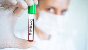 Test, test, test—that is the credo at the moment, and it is the only way to really understand how much the coronavirus is spreading. this indicates that the belief in the validity of the pcr tests is so strong. Ubersetzung Der Pcr Covid 19 Tests