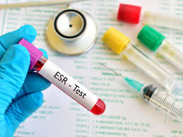 Esr Test Procedure Results And Risks
