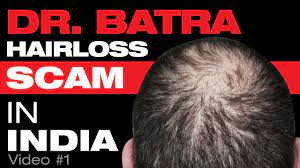 I had this hair serum with me since few months in the dr. Dr Batra S Hair Loss Treatment Scam Growing Hair Back Is Not Possible Youtube