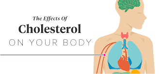 Can high cholesterol cause a stroke. The Effects Of Cholesterol On The Body