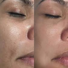 See more ideas about glow, skin treatments, led light therapy. Bb Glow Altena Cosmetics Kosmetik Spezialistin Aus Der Grafschaft