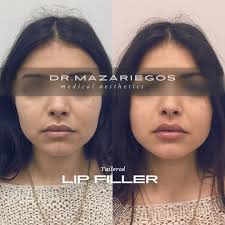 Profile for Dr.Gustavo Mazariegos Florentino