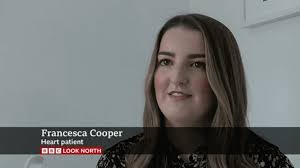 Revolutionary valve procedure performed in Leeds