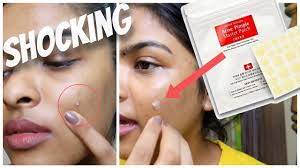 Opt for the klog soft shield pimple patch. What Acne Gone In 24 Hours Acne Pimple Patch Test Korean Skin Care Routine Ft Yesstyle Youtube