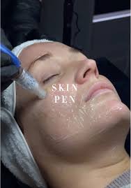 SkinPen: The Science of Skin Renewal Did you know that microneedling t...