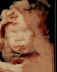 Baby brother is just darling! 💙💙, He’s measuring ahead and growing  perfectly. From some angles he has the most chunky cheeks!! He looks so  much like big brother. , We have a set name for him and now ...