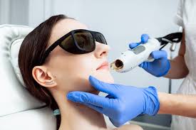 לייזר בטכנולוגית OPL...