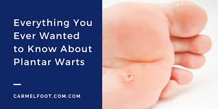 Cover with a piece of medical tape or with bandage and repeat the procedure twice a day for faster results. What You Should Know About Plantar Warts Carmel Foot Specialists
