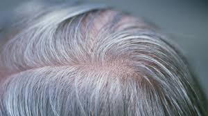 Grey Hair Gene Discovered By Scientists Grey Hair Prevent Grey Hair Grey Hair Treatment