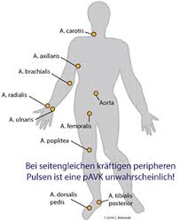 Periphere Verschlusskrankheit Wpgefaessmanual2016