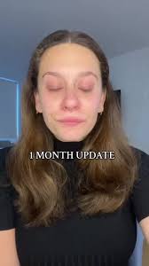 Emily Ward Lost 8lbs