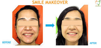 Advanced Cosmetic Dentistry