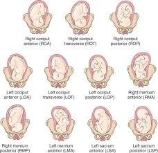 اتجاه الجنين (Fetal Orientation)