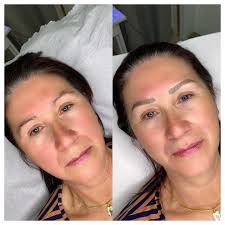 Indiara Steiger Schimmock Micropigmentação