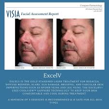 COMPASS DERMATOLOGY (@compassdermatology) · Instagram 照片和视频