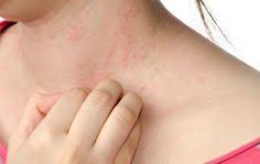 Pin Su Cure Preventive
