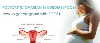 Conventional treatment of pcos includes a range of oral pharmacological. What Women Need To Know About Polycystic Ovary Syndrome Pcos Herts Essex Fertility Centre