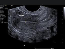 Image result for Ultrasound