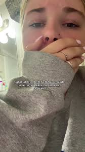 Why Did Rugballs Delete His Account