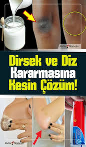 Dirsek Ve Diz Kararmasi Ile Ilgili Butun Merak Ettiklerinizi Detayli Olarak Bulabileceginiz Bu Yazimizdaki Onerileri Uyg Cilt Bakimi Cilt Urunleri Saglik Bakim