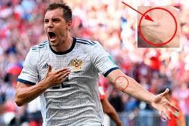 Чемпионата мира по футболу 2018 года. Chempionat Mira Po Futbolu 2018 Otkuda U Dzyuby Sled Ot Ukola Na Ruke Chempionat