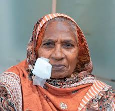 The Fred Hollows Foundation Annual Report 2023