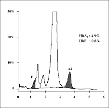 Making payments and paying bills each month can be a lot easier using a current account with a chequebook. High Performance Liquid Chromatography Hplc As A Screening Tool For Classical Beta Thalassaemia Trait In Malaysia Abstract Europe Pmc