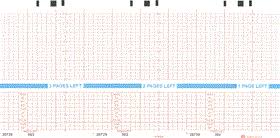 Hp Philips Equivalent To M1910a 989803105491 Fetal Monitor