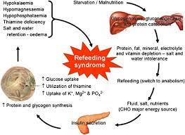 Nutrition In Clinical Practice—The Refeeding Syndrome: Illustrative Cases  And Guidelines For Prevention And Treatment | European Journal Of Clinical  Nutrition