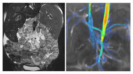 MRI: Clinical Updates and Practical Physics