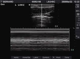 Image result for Pulmonary Intoxicant