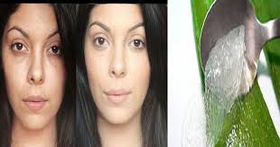 To use aloe vera for your age spots, start by applying aloe juice to the spots twice a day. Home Remedies Aloe Vera For Dark Spots