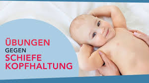 Schiefe Kopfhaltung Bei Babys Korrigieren Youtube
