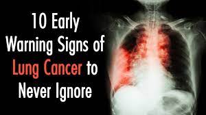 In its early stages, lung cancer doesn't typically have symptoms you can see or feel. 10 Early Warning Signs Of Lung Cancer To Never Ignore