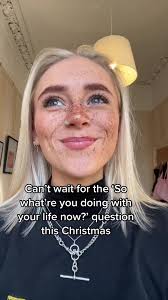 Dealing with Christmas Questions: To Fake Injury or Lie?