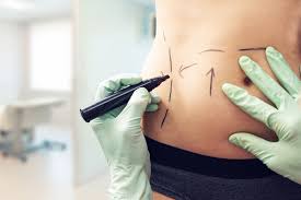 If successful, mohs surgery should remove all of the cancerous skin, leaving the healthy skin surrounding it. Trading Sex For Cosmetic Surgery In Mexico S Narco Capital Bbc News