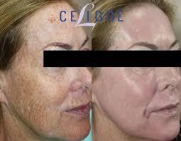 Kevin DiCerbo, RN, BSN