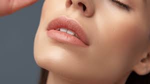 Looking to Smooth Out Your Smile Lines? RADIESSE® May be For You