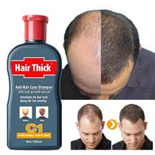 These products often use ingredients that claim to support a healthy scalp, which is more hospitable to hair growth. Fast Hair Growth Shampoo Herbal Repair Damaged Coarse Anti Hair Loss Serum Unisex 100ml Buy Online In Dominica At Dominica Desertcart Com Productid 97295199