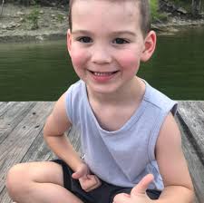 How can I get information and photos of children who have suffered from AVM?