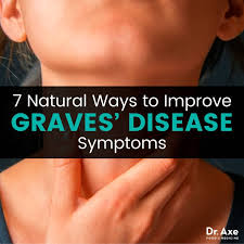 Consult a doctor for medical advice. Graves Disease 7 Ways To Help Manage Symptoms Dr Axe
