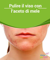 Il tonico viso fai da te con aceto di mele è una delle ricette più apprezzate perché, anche se acido, in realtà aiuta a regolare l'equilibrio del ph della pelle, ha proprietà antinfiammatorie, è antibatterico e può essere usato da tutti i tipi di pelle; Aceto Di Mele Sulla Pelle Tutti I Benefici Vivere Piu Sani Cura Del Viso Consigli Di Bellezza Al Naturale Aceto Di Mele