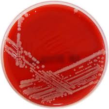 Image result for Rhizobium radiobacter, syn. Agrobacterium tumefaciens