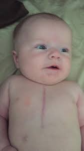 Since I had so many comment about my "hairy belly" saying that I need to  shave my stomach, I figured I would fill you all in. I had surgery two  years ago